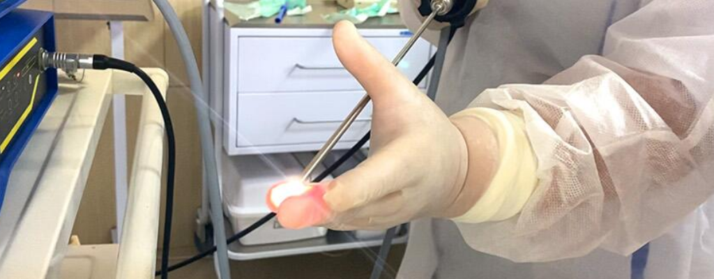 Цистоскопия (Фиброцистоскопия) у мужчин + Консультация уролога